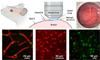 New cannula system delivers imaging agents directly to the brain.