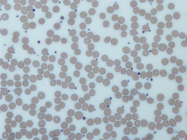 Platelets: new details of their behavior
