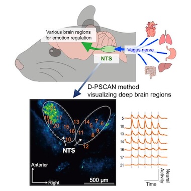 Window on the NTS: neural circuits seen