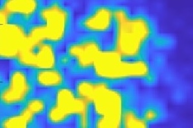 Burned vs healthy: THz response