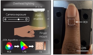 Color mix: accurate oximetry