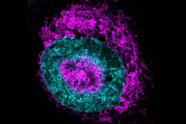 Cause and effect: mitochondria movement