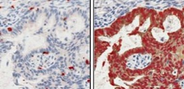 Features identified: MARQO