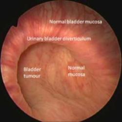 Confocal Raman spectoscopy