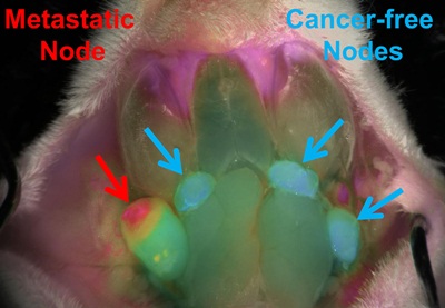 Imaging cancer spread in mice