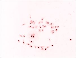 Cells living and dead