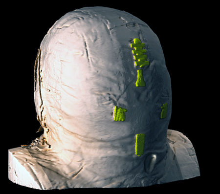 All wrapped up: The 2000-year old Rhind Mummy.