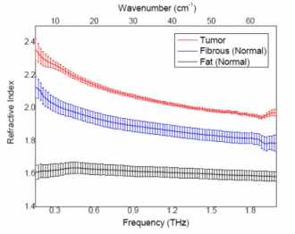 THz spots the difference in breast cancer tissue