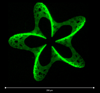 Precision attachment: 3D pattern, produced by laser photo-grafting. 