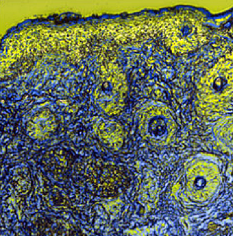 The BiophotonicsPlus competition for R&D Funding starts on 1 October.