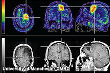 New imaging techniques will help clinicians better understand how tumors develop.