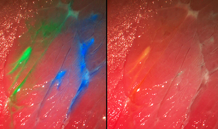 The camera displays colored structures by means of fluorescent dyes.