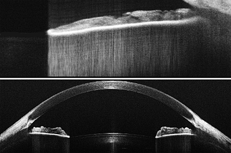 Wasatch's 1300nm OCT solutions suit dermatology, anterior segment imaging and material inspection.