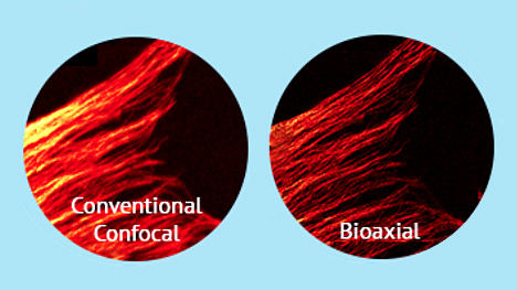 Extended imaging of live cells with improved resolution.