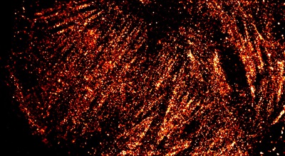 Super-resolved cytoskeleton