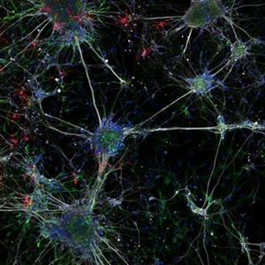 Extraordinary imaging