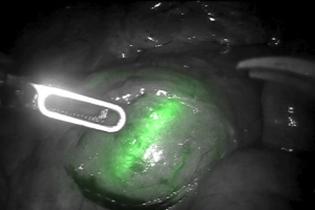 First do no harm: fluorescence shows the way