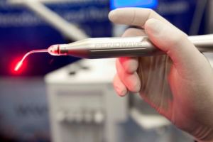 The Periowave system