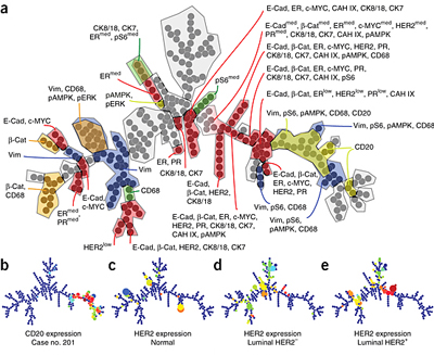Zurich group's imaging mass cytometry analysis of tumor heterogeneity.