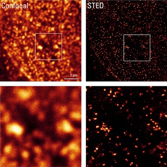 Beyond the diffraction limit: STED