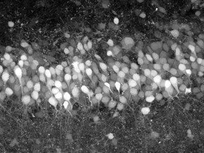Two-photon imaging of neurons
