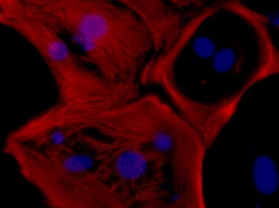 Cardiomyocyte cells