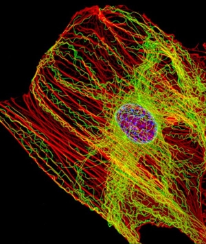 Actin filaments