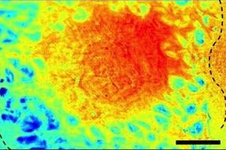 Under the skin: oxygen comsumption suffers