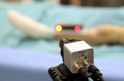 Keep still: Photonics measuring system for determining leg length.