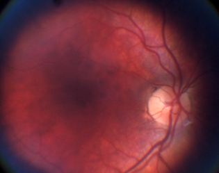 Improve your self-image: eyeSelfie