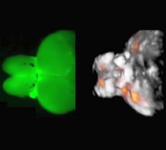 Optoacoustic imaging of the brain
