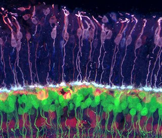 Brain Initiative: seeing the connections