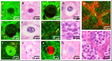 Histopathology correlation