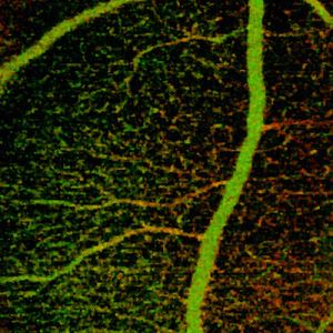 OCT angiography: structural and blood flow information.