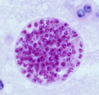 Room for improvement: conventional imaging of T. gondii