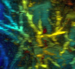 Skin deeper: imaging of tissues