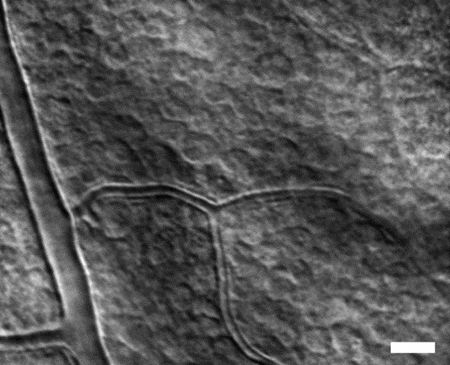 Retinal ganglion cell layer in a rhesus macaque monkey (scale bar is 25µm).