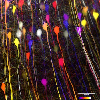 Airy LSM: seeing nerves in action