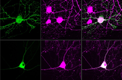 MIT researchers have devised a way to control single neurons using optogenetics. 