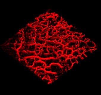 Blood vessel network: key to cancer growth