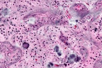 Raman histology: a faster diagnosis