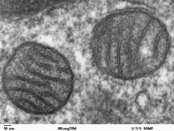 Mitochondria seen by SEM: Photothermal imaging offers an alternative