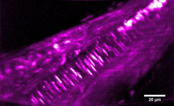 Benefits of an Airy profile: seeing more clearly