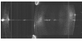 OCT image of the eye's anterior segment