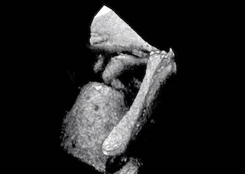 Hearing aid: visualizing the middle ear