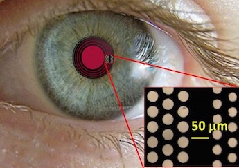 Hole story: treating presbyopia